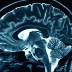 The Intersection of Neuroscience and Soccer