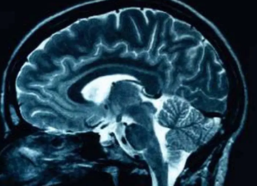 The Intersection of Neuroscience and Soccer