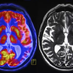 The Science Behind Soccer’s Magic Hold on You